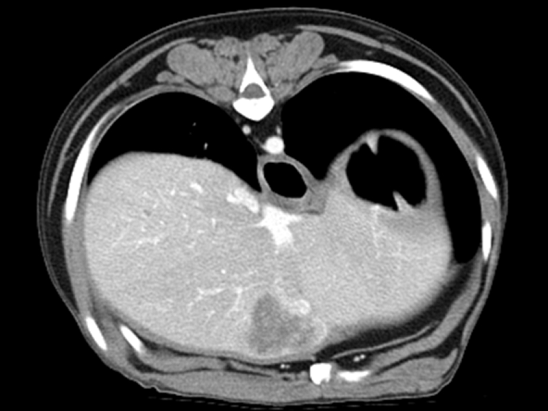 Portal phase